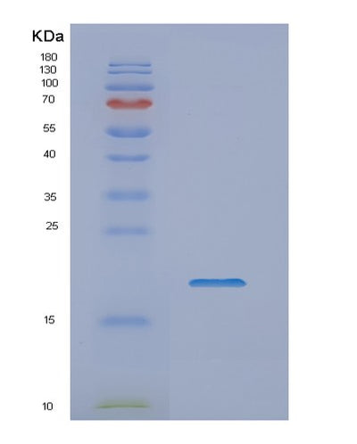 SDS-PAGE analysis of Human NME1 (Nucleoside Diphosphate Kinase A) - Recombinant Protein, CAT# BLT-02035P, showing >85% purity under 15% SDS-PAGE (Reduced)Human NME1 (Nucleoside Diphosphate Kinase A) - Recombinant Protein
