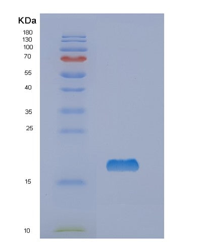 SDS-PAGE analysis of Human NME1 (Nucleoside Diphosphate Kinase A) - Recombinant Protein, CATHuman NME1 (Nucleoside Diphosphate Kinase A) - Recombinant Protein