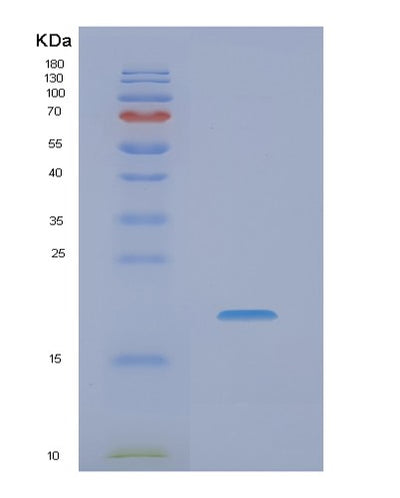 SDS-PAGE analysis of Human NME4 (Nucleoside Diphosphate Kinase, Mitochondrial) - Recombinant Protein, CAT# BLT-02041P, showing >95% purity under 15% SDS-PAGE (Reduced)Human NME4 (Nucleoside Diphosphate Kinase, Mitochondrial) - Recombinant Protein