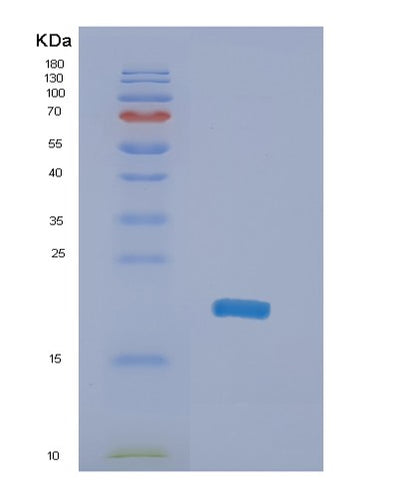 SDS-PAGE analysis of Human NME4 (Nucleoside Diphosphate Kinase, Mitochondrial) - Recombinant Protein, CAT# BLT-02042P, showing >90% purity under 15% SDS-PAGE (Reduced)Human NME4 (Nucleoside Diphosphate Kinase, Mitochondrial) - Recombinant Protein