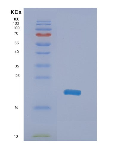 SDS-PAGE analysis of Human NME4 (Nucleoside Diphosphate Kinase, Mitochondrial) - Recombinant Protein, CATHuman NME4 (Nucleoside Diphosphate Kinase, Mitochondrial) - Recombinant Protein
