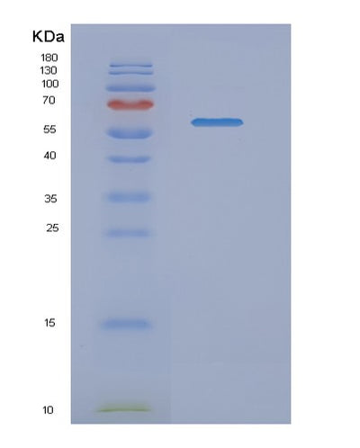 SDS-PAGE analysis of Human NMT1 (Glycylpeptide N-Tetradecanoyltransferase 1) - Recombinant Protein, CAT# BLT-02048P, showing >90% purity under 15% SDS-PAGE (Reduced)Human NMT1 (Glycylpeptide N-Tetradecanoyltransferase 1) - Recombinant Protein