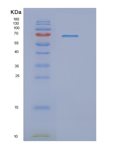SDS-PAGE analysis of Human NFE2L2 (Nuclear Factor Erythroid 2-Related Factor 2) - Recombinant Protein, CAT# BLT-02065P, showing >95% purity under 15% SDS-PAGE (Reduced)Human NFE2L2 (Nuclear Factor Erythroid 2-Related Factor 2) - Recombinant Protein