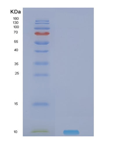 SDS-PAGE analysis of Human NRG4 (Pro-Neuregulin-4, Membrane-Bound Isoform) - Recombinant Protein, CAT# BLT-02066P, showing >90% purity under 15% SDS-PAGE (Reduced)Human NRG4 (Pro-Neuregulin-4, Membrane-Bound Isoform) - Recombinant Protein
