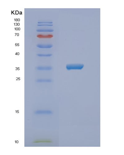 SDS-PAGE analysis of Human NSDHL (Sterol-4-Alpha-Carboxylate 3-Dehydrogenase, Decarboxylating) - Recombinant Protein, CAT# BLT-02071P, showing >90% purity under 15% SDS-PAGE (Reduced)Human NSDHL (Sterol-4-Alpha-Carboxylate 3-Dehydrogenase, Decarboxylating) - Recombinant Protein