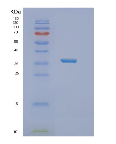 SDS-PAGE analysis of Human NT5C3B (7-Methylguanosine Phosphate-Specific 5&Human NT5C3B (7-Methylguanosine Phosphate-Specific 5'-Nucleotidase) - Recombinant Protein