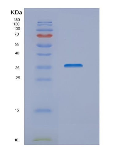 SDS-PAGE analysis of Human NUBP1 (Cytosolic Fe-S Cluster Assembly Factor Nubp1) - Recombinant Protein, CAT# BLT-02084P, showing >95% purity under 15% SDS-PAGE (Reduced)Human NUBP1 (Cytosolic Fe-S Cluster Assembly Factor Nubp1) - Recombinant Protein