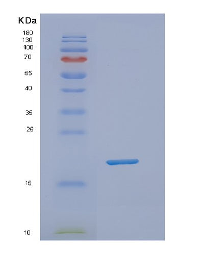 SDS-PAGE analysis of Human NUDT1 (Oxidized Purine Nucleoside Triphosphate Hydrolase) - Recombinant Protein, CAT# BLT-02089P, showing >85% purity under 15% SDS-PAGE (Reduced)Human NUDT1 (Oxidized Purine Nucleoside Triphosphate Hydrolase) - Recombinant Protein
