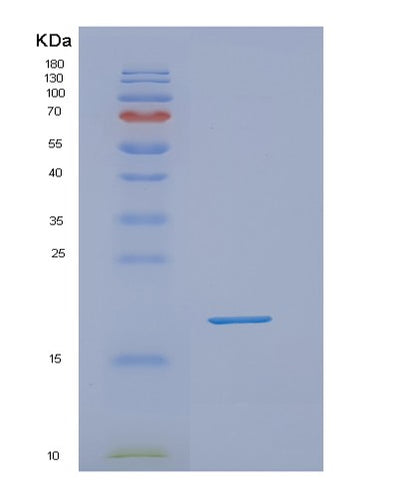SDS-PAGE analysis of Human NUDT10 (Diphosphoinositol Polyphosphate Phosphohydrolase 3-Alpha) - Recombinant Protein, CAT# BLT-02090P, showing >95% purity under 15% SDS-PAGE (Reduced)Human NUDT10 (Diphosphoinositol Polyphosphate Phosphohydrolase 3-Alpha) - Recombinant Protein