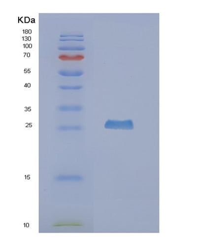 SDS-PAGE analysis of Human NUDT5 (Adp-Sugar Pyrophosphatase) - Recombinant Protein, CAT# BLT-02098P, showing >85% purity under 15% SDS-PAGE (Reduced)Human NUDT5 (Adp-Sugar Pyrophosphatase) - Recombinant Protein