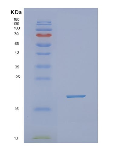 SDS-PAGE analysis of Human NXT1 (Ntf2-Related Export Protein 1) - Recombinant Protein, CAT# BLT-02103P, showing >85% purity under 15% SDS-PAGE (Reduced)Human NXT1 (Ntf2-Related Export Protein 1) - Recombinant Protein