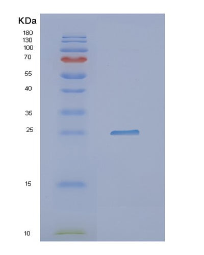 SDS-PAGE analysis of Human NXT2 (Ntf2-Related Export Protein 2) - Recombinant Protein, CAT# BLT-02104P, showing >95% purity under 15% SDS-PAGE (Reduced)Human NXT2 (Ntf2-Related Export Protein 2) - Recombinant Protein
