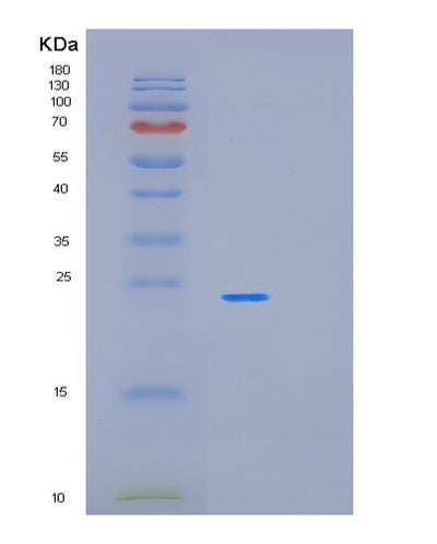 SDS-PAGE analysis of Human OLR1 (Oxidized Low-Density Lipoprotein Receptor 1) - Recombinant Protein, CAT# BLT-02115P, showing >95% purity under 15% SDS-PAGE (Reduced)Human OLR1 (Oxidized Low-Density Lipoprotein Receptor 1) - Recombinant Protein