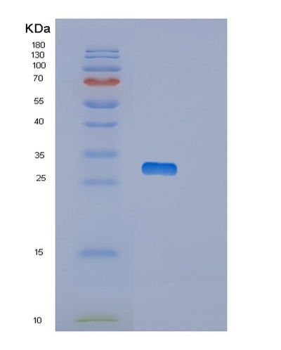 SDS-PAGE analysis of Human OTUB2 (Ubiquitin Thioesterase Otub2) - Recombinant Protein, CAT# BLT-02135P, showing >85% purity under 15% SDS-PAGE (Reduced)Human OTUB2 (Ubiquitin Thioesterase Otub2) - Recombinant Protein