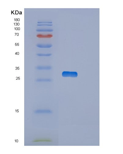 SDS-PAGE analysis of Human OTUB2 (Ubiquitin Thioesterase Otub2) - Recombinant Protein, CATHuman OTUB2 (Ubiquitin Thioesterase Otub2) - Recombinant Protein