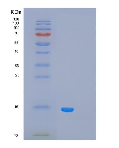 SDS-PAGE analysis of Human PCBD1 (Pterin-4-Alpha-Carbinolamine Dehydratase) - Recombinant Protein, CAT# BLT-02165P, showing >85% purity under 15% SDS-PAGE (Reduced)Human PCBD1 (Pterin-4-Alpha-Carbinolamine Dehydratase) - Recombinant Protein