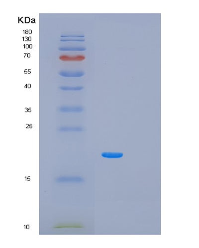 SDS-PAGE analysis of Human PCBP1 (Poly(Rc)-Binding Protein 1) - Recombinant Protein, CAT# BLT-02166P, showing >95% purity under 15% SDS-PAGE (Reduced)Human PCBP1 (Poly(Rc)-Binding Protein 1) - Recombinant Protein