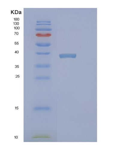 SDS-PAGE analysis of Human PINX1 (Pin2/Terf1-Interacting Telomerase Inhibitor 1) - Recombinant Protein, CAT# BLT-02271P, showing >85% purity under 15% SDS-PAGE (Reduced)Human PINX1 (Pin2/Terf1-Interacting Telomerase Inhibitor 1) - Recombinant Protein