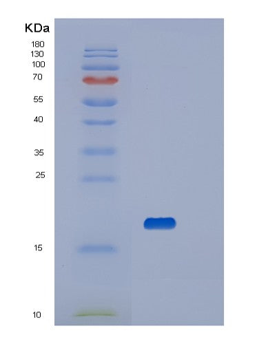 SDS-PAGE analysis of Human VSIR (V-Type Immunoglobulin Domain-Containing Suppressor Of T-Cell Activation) - Recombinant Protein, CATHuman VSIR (V-Type Immunoglobulin Domain-Containing Suppressor Of T-Cell Activation) - Recombinant Protein