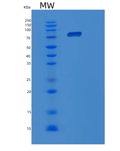 SDS-PAGE analysis of Human POR (Nadph--Cytochrome P450 Reductase) - Recombinant Protein, CAT# BLT-02332P, showing >90% purity under 15% SDS-PAGE (Reduced)Human POR (Nadph--Cytochrome P450 Reductase) - Recombinant Protein