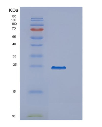 SDS-PAGE analysis of Human PPCDC (Phosphopantothenoylcysteine Decarboxylase) - Recombinant Protein, CAT# BLT-02339P, showing >95% purity under 15% SDS-PAGE (Reduced)Human PPCDC (Phosphopantothenoylcysteine Decarboxylase) - Recombinant Protein