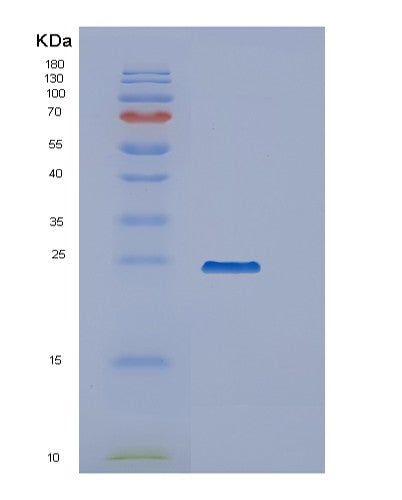 SDS-PAGE analysis of Human PPCDC (Phosphopantothenoylcysteine Decarboxylase) - Recombinant Protein, CATHuman PPCDC (Phosphopantothenoylcysteine Decarboxylase) - Recombinant Protein