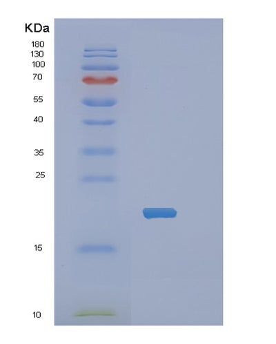 SDS-PAGE analysis of Human PPP1R14A (Protein Phosphatase 1 Regulatory Subunit 14A) - Recombinant Protein, CAT# BLT-02355P, showing >90% purity under 15% SDS-PAGE (Reduced)Human PPP1R14A (Protein Phosphatase 1 Regulatory Subunit 14A) - Recombinant Protein