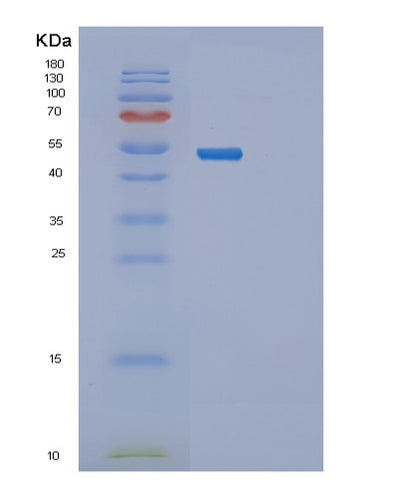SDS-PAGE analysis of Human PRKAR2A (Camp-Dependent Protein Kinase Type Ii-Alpha Regulatory Subunit) - Recombinant Protein, CAT# BLT-02377P, showing >95% purity under 15% SDS-PAGE (Reduced)Human PRKAR2A (Camp-Dependent Protein Kinase Type Ii-Alpha Regulatory Subunit) - Recombinant Protein