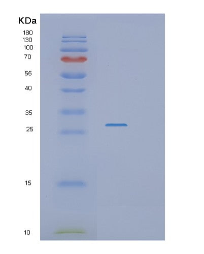 SDS-PAGE analysis of Human RASSF3 (Ras Association Domain-Containing Protein 3) - Recombinant Protein, CATHuman RASSF3 (Ras Association Domain-Containing Protein 3) - Recombinant Protein