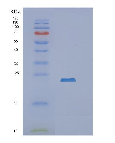 SDS-PAGE analysis of Human RBP4 (Retinol-Binding Protein 4) - Recombinant Protein, CATHuman RBP4 (Retinol-Binding Protein 4) - Recombinant Protein