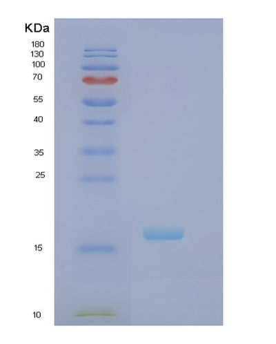 SDS-PAGE analysis of Human RBP7 (Retinoid-Binding Protein 7) - Recombinant Protein, CAT# BLT-02545P, showing >95% purity under 15% SDS-PAGE (Reduced)Human RBP7 (Retinoid-Binding Protein 7) - Recombinant Protein
