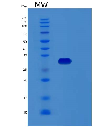 SDS-PAGE analysis of Human RCHY1 (Ring Finger And Chy Zinc Finger Domain-Containing Protein 1) - Recombinant Protein, CAT# BLT-02548P, showing >95% purity under 15% SDS-PAGE (Reduced)Human RCHY1 (Ring Finger And Chy Zinc Finger Domain-Containing Protein 1) - Recombinant Protein