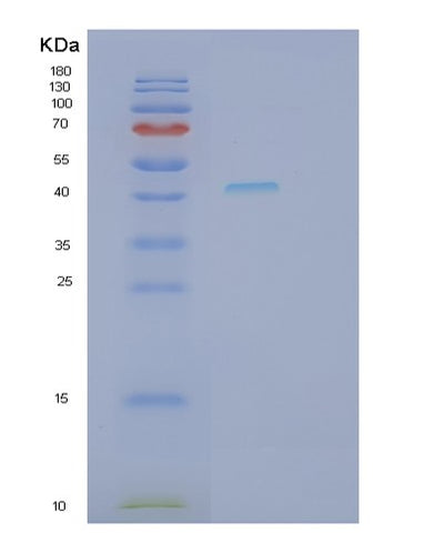 SDS-PAGE analysis of Human REN (Renin) - Recombinant Protein, CAT# BLT-02557P, showing >90% purity under 15% SDS-PAGE (Reduced)Human REN (Renin) - Recombinant Protein