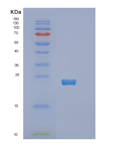 SDS-PAGE analysis of Human RNF4 (E3 Ubiquitin-Protein Ligase Rnf4) - Recombinant Protein, CATHuman RNF4 (E3 Ubiquitin-Protein Ligase Rnf4) - Recombinant Protein