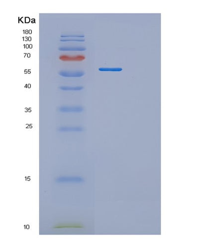 SDS-PAGE analysis of Human RNMT (Mrna Cap Guanine-N(7) Methyltransferase) - Recombinant Protein, CAT# BLT-02604P, showing >95% purity under 15% SDS-PAGE (Reduced)Human RNMT (Mrna Cap Guanine-N(7) Methyltransferase) - Recombinant Protein