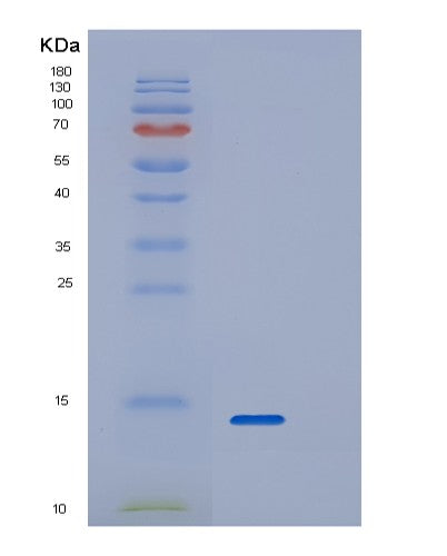 SDS-PAGE analysis of Human RPAIN (Rpa-Interacting Protein) - Recombinant Protein, CATHuman RPAIN (Rpa-Interacting Protein) - Recombinant Protein