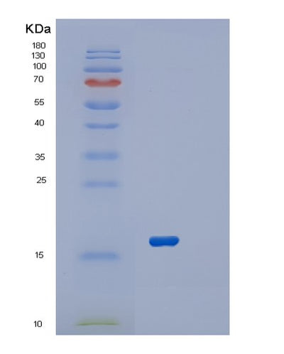 SDS-PAGE analysis of Human RPL22 (Large Ribosomal Subunit Protein El22) - Recombinant Protein, CAT# BLT-02614P, showing >85% purity under 15% SDS-PAGE (Reduced)Human RPL22 (Large Ribosomal Subunit Protein El22) - Recombinant Protein
