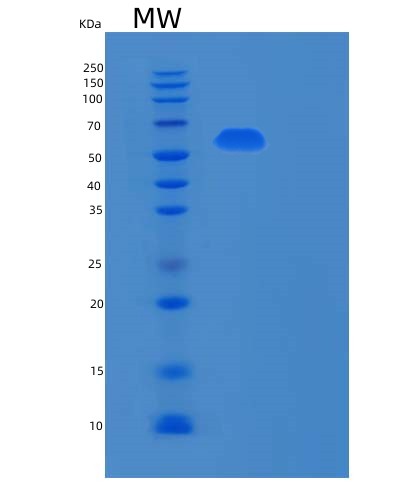 SDS-PAGE analysis of Human RPN2 (Dolichyl-Diphosphooligosaccharide--Protein Glycosyltransferase Subunit 2) - Recombinant Protein, CAT# BLT-02626P, showing >85% purity under 15% SDS-PAGE (Reduced)Human RPN2 (Dolichyl-Diphosphooligosaccharide--Protein Glycosyltransferase Subunit 2) - Recombinant Protein