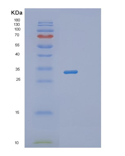 SDS-PAGE analysis of Human RWDD1 (Rwd Domain-Containing Protein 1) - Recombinant Protein, CATHuman RWDD1 (Rwd Domain-Containing Protein 1) - Recombinant Protein