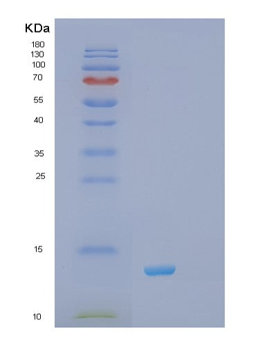 SDS-PAGE analysis of Human RXRA (Retinoic Acid Receptor Rxr-Alpha) - Recombinant Protein, CATHuman RXRA (Retinoic Acid Receptor Rxr-Alpha) - Recombinant Protein