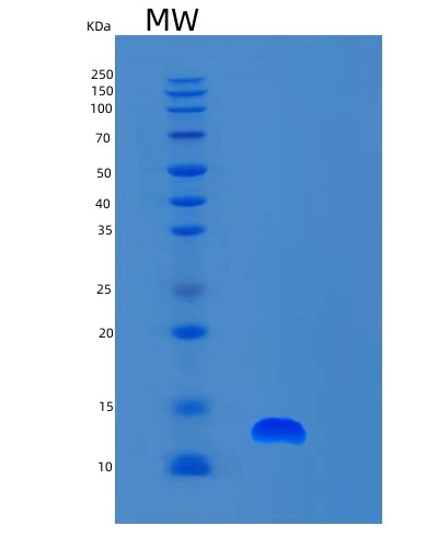 SDS-PAGE analysis of Human S100A6 (Protein S100-A6) - Recombinant Protein, CAT# BLT-02676P, showing >90% purity under 15% SDS-PAGE (Reduced)Human S100A6 (Protein S100-A6) - Recombinant Protein