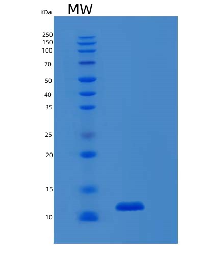 SDS-PAGE analysis of Human S100B (Protein S100-B) - Recombinant Protein, CAT# BLT-02684P, showing >95% purity under 15% SDS-PAGE (Reduced)Human S100B (Protein S100-B) - Recombinant Protein