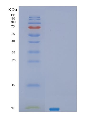 SDS-PAGE analysis of Human SEC61B (Protein Transport Protein Sec61 Subunit Beta) - Recombinant Protein, CAT# BLT-02723P, showing >95% purity under 15% SDS-PAGE (Reduced)Human SEC61B (Protein Transport Protein Sec61 Subunit Beta) - Recombinant Protein
