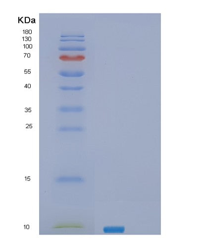 SDS-PAGE analysis of Human SEC61B (Protein Transport Protein Sec61 Subunit Beta) - Recombinant Protein, CATHuman SEC61B (Protein Transport Protein Sec61 Subunit Beta) - Recombinant Protein