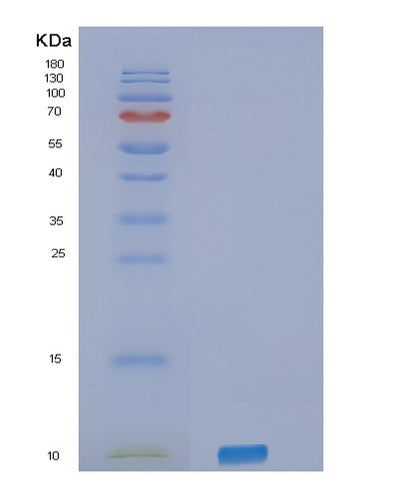 SDS-PAGE analysis of Human SELPLG (P-Selectin Glycoprotein Ligand 1) - Recombinant Protein, CAT# BLT-02725P, showing >95% purity under 15% SDS-PAGE (Reduced)Human SELPLG (P-Selectin Glycoprotein Ligand 1) - Recombinant Protein