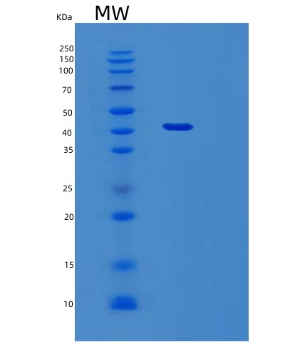 SDS-PAGE analysis of Human SEPTIN3 (Neuronal-Specific Septin-3) - Recombinant Protein, CAT# BLT-02732P, showing >90% purity under 15% SDS-PAGE (Reduced)Human SEPTIN3 (Neuronal-Specific Septin-3) - Recombinant Protein