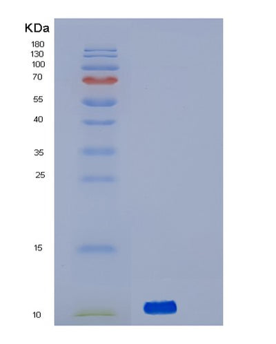 SDS-PAGE analysis of Human ACVRL1 (Activin Receptor Type-1-Like) - Recombinant Protein, CAT# BLT-02738P, showing >90% purity under 15% SDS-PAGE (Reduced)Human ACVRL1 (Activin Receptor Type-1-Like) - Recombinant Protein