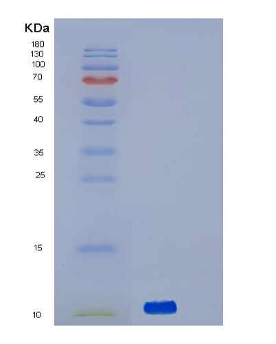 SDS-PAGE analysis of Human ACVRL1 (Activin Receptor Type-1-Like) - Recombinant Protein, CATHuman ACVRL1 (Activin Receptor Type-1-Like) - Recombinant Protein