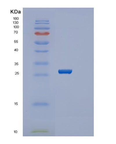 SDS-PAGE analysis of Human SERTAD1 (Serta Domain-Containing Protein 1) - Recombinant Protein, CAT# BLT-02749P, showing >95% purity under 15% SDS-PAGE (Reduced)Human SERTAD1 (Serta Domain-Containing Protein 1) - Recombinant Protein