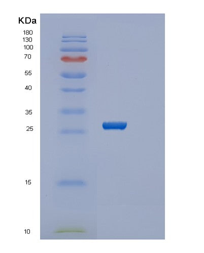 SDS-PAGE analysis of Human SERTAD1 (Serta Domain-Containing Protein 1) - Recombinant Protein, CATHuman SERTAD1 (Serta Domain-Containing Protein 1) - Recombinant Protein